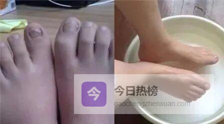 白醋4大神技：泡脚、去灰、助眠、美颜一次讲透