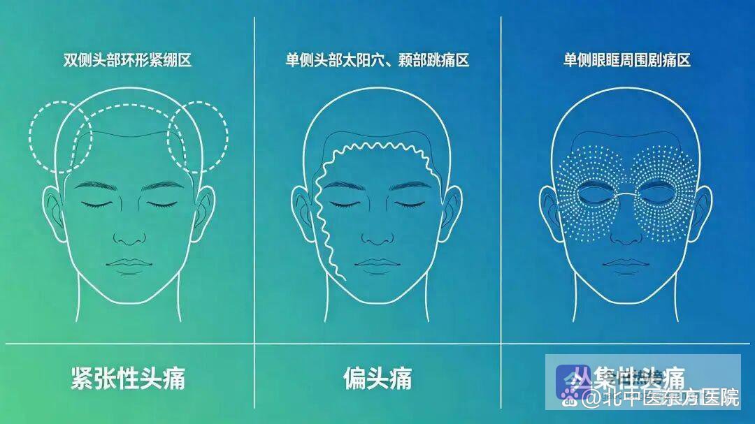 「医学小常识」别把头痛当小事！一文教你识别致命预警