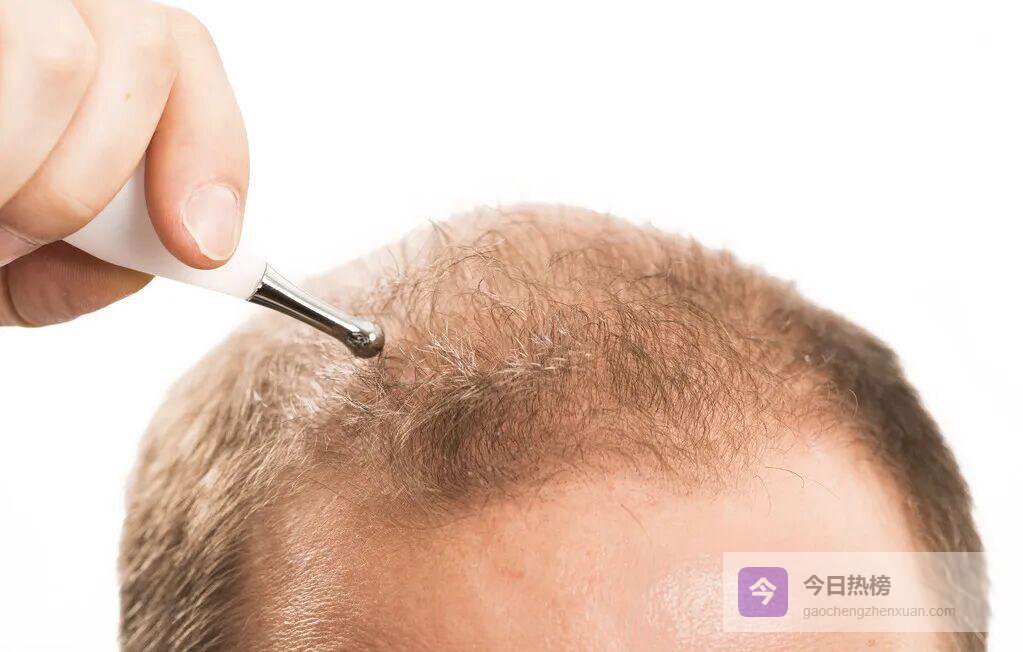 头皮裂伤急救与康复一步到位手册